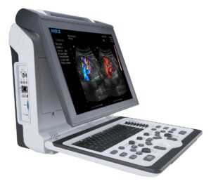 Ultrasonografy